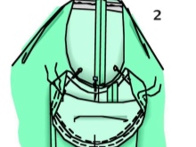 Pulling in sleeves - step 2