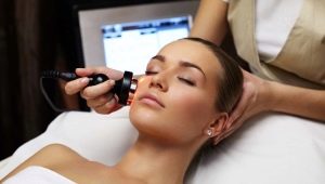 RF lifting: what is it and how is it performed?