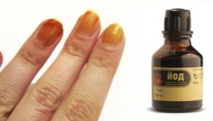 Nail iodine: from effect to use