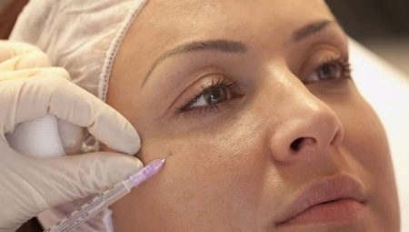 Facial mesotherapy: what is it and how is it done?