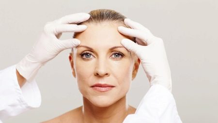 Facelift: the need for procedures and rules