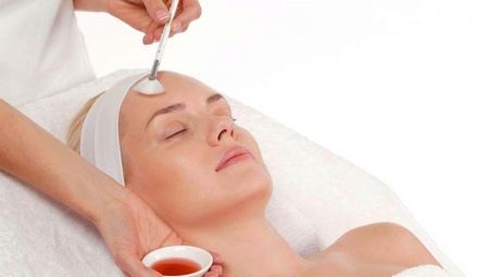 Superficial peeling of the face: what is it and how is it performed?