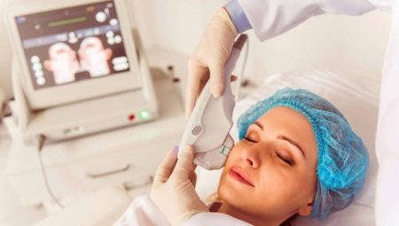 SMAS lifting: what is it and how is it performed?