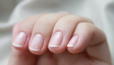 Causes and treatment of nail cuticle inflammation