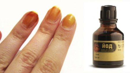 Nail iodine: from effect to use
