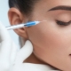 Non-surgical blepharoplasty: features and technology of