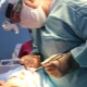 Features of the procedure endoscopic facelift