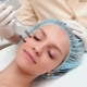 Laser facial rejuvenation: features, types and technology of