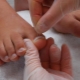 Toenails grow up: causes and methods of treatment