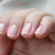 Causes and treatment of nail cuticle inflammation