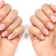 Layered nails: causes, treatment and prevention